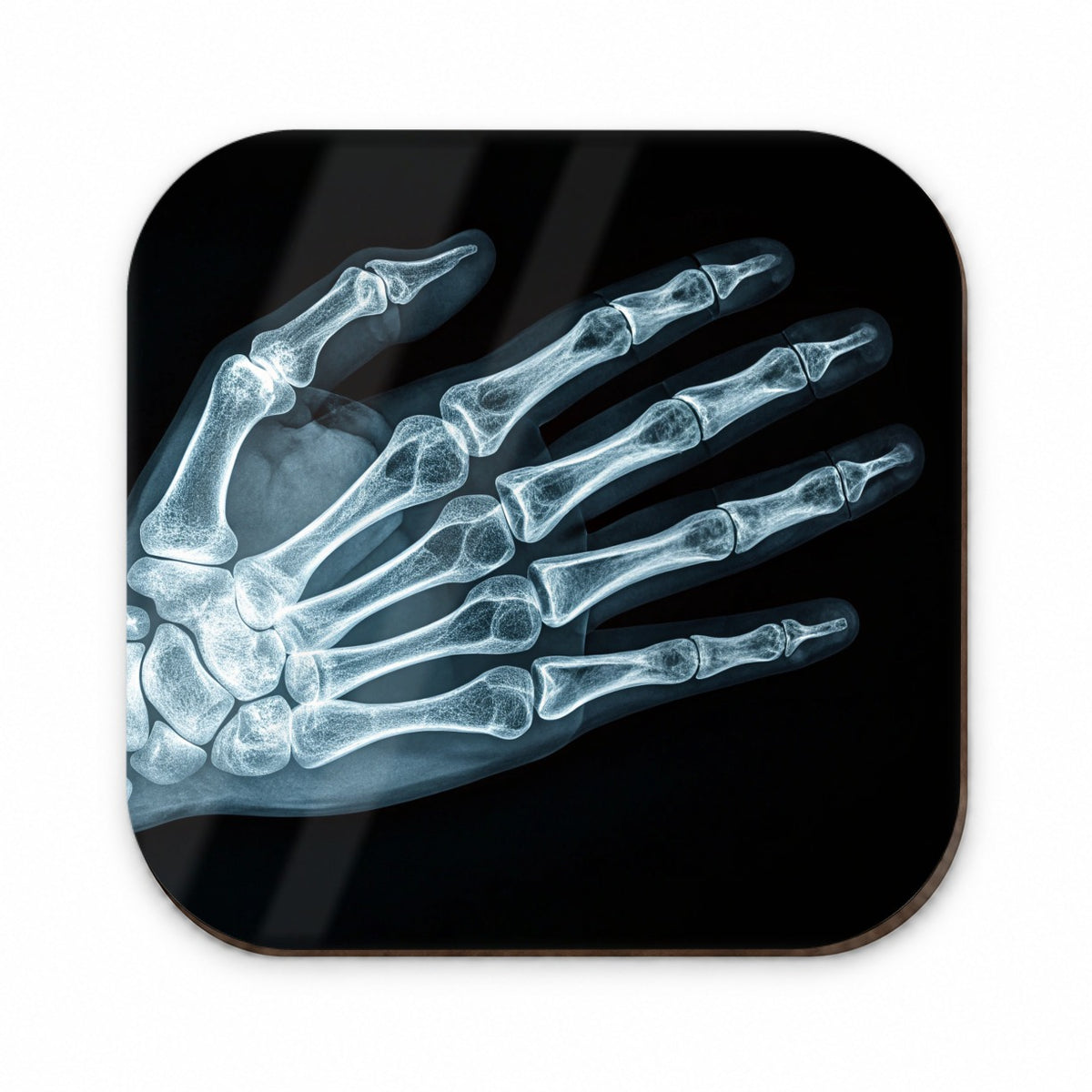 Hand X-Ray Radiograph Fridge Magnet